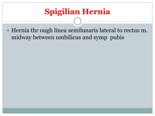 Spigilian Hernia
 Hernia thr ough linea semilunaris lateral to rectus m.
midway between umbilicus and symp pubis
 