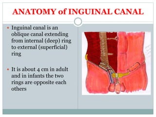 ANATOMY of INGUINAL CANAL
 Inguinal canal is an
oblique canal extending
from internal (deep) ring
to external (superficial)
ring
 It is about 4 cm in adult
and in infants the two
rings are opposite each
others
 
