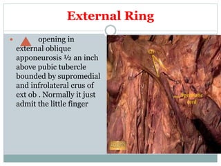 External Ring
 opening in
external oblique
apponeurosis ½ an inch
above pubic tubercle
bounded by supromedial
and infrolateral crus of
ext ob . Normally it just
admit the little finger
 