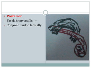  Posterior
- Fascia tranversalis +
- Conjoint tendon laterally
 