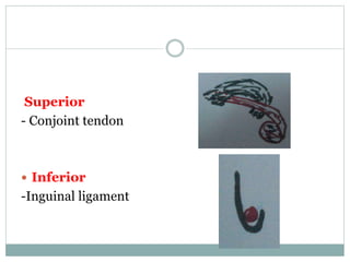 Superior
- Conjoint tendon
 Inferior
-Inguinal ligament
 