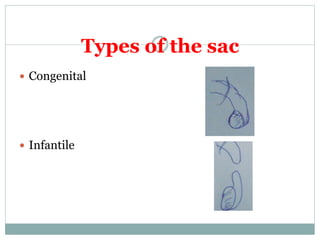Types of the sac
 Congenital
 Infantile
 
