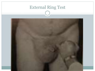 External Ring Test
 