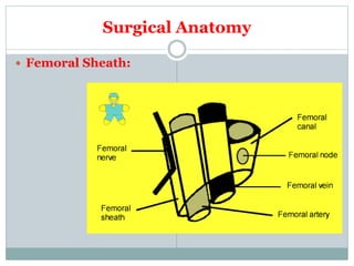 Surgical Anatomy
 Femoral Sheath:
 