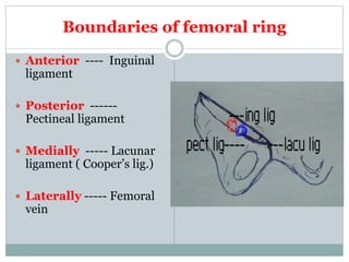 Boundaries of femoral ring
 Anterior ---- Inguinal
ligament
 Posterior ------
Pectineal ligament
 Medially ----- Lacunar
ligament ( Cooper’s lig.)
 Laterally ----- Femoral
vein
 