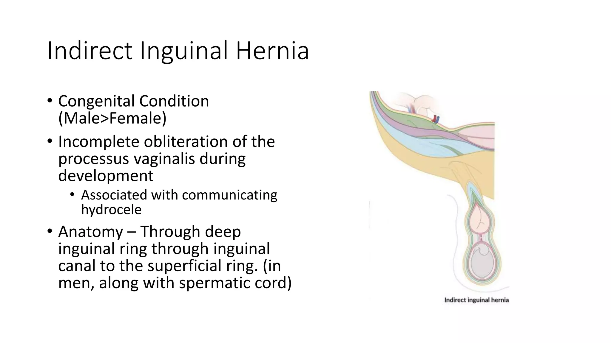 Hernia and Approach to Testicular Pain.pptx