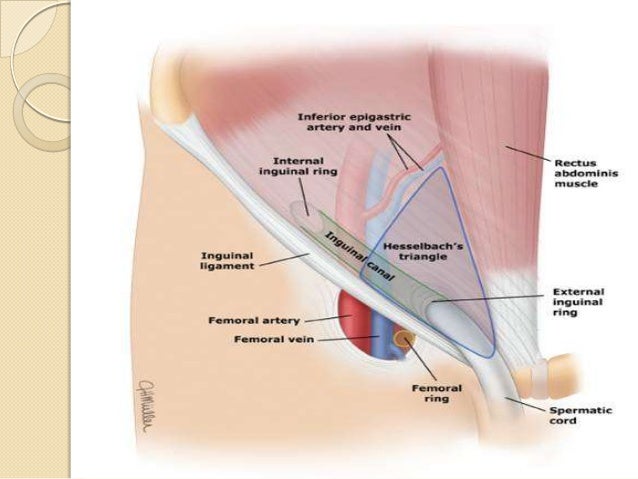 herniorrhaphy