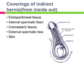 Coverings of indirect
hernia(from inside out)
• Extraperitoneal tissue
• Internal spermatic fascia
• Cremasteric fascia
• External spermatic fascia
• Skin
 