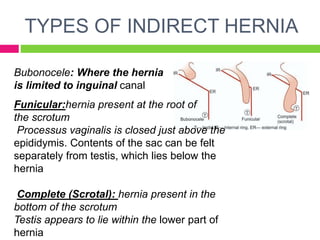 TYPES OF INDIRECT HERNIA
Bubonocele: Where the hernia
is limited to inguinal canal
Funicular:hernia present at the root of
the scrotum
Processus vaginalis is closed just above the
epididymis. Contents of the sac can be felt
separately from testis, which lies below the
hernia
Complete (Scrotal): hernia present in the
bottom of the scrotum
Testis appears to lie within the lower part of
hernia
 
