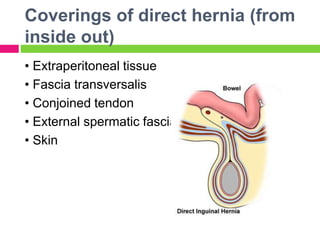 Coverings of direct hernia (from
inside out)
• Extraperitoneal tissue
• Fascia transversalis
• Conjoined tendon
• External spermatic fascia
• Skin
 