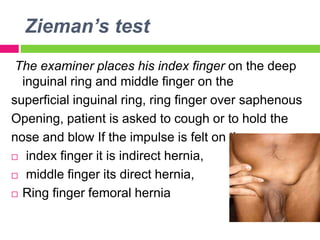 Zieman’s test
The examiner places his index finger on the deep
inguinal ring and middle finger on the
superficial inguinal ring, ring finger over saphenous
Opening, patient is asked to cough or to hold the
nose and blow If the impulse is felt on the
 index finger it is indirect hernia,
 middle finger its direct hernia,
 Ring finger femoral hernia
 