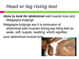 Head or leg rising test
done to look for abdominal wall muscle tone and
Malgaigne bulgings
Malgaigne bulgings are It is protrusion of
abdominal wall muscles during leg rising test as
weak, soft, supple, swelling, which signifies
poor abdominal muscle tone
 