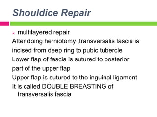 Shouldice Repair
 multilayered repair
After doing herniotomy ,transversalis fascia is
incised from deep ring to pubic tubercle
Lower flap of fascia is sutured to posterior
part of the upper flap
Upper flap is sutured to the inguinal ligament
It is called DOUBLE BREASTING of
transversalis fascia
 