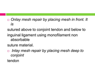  Onlay mesh repair by placing mesh in front. It
is
sutured above to conjoint tendon and below to
inguinal ligament using monofilament non
absorbable
suture material.
 Inlay mesh repair by placing mesh deep to
conjoint
tendon
 