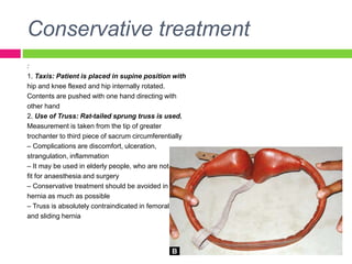 Conservative treatment
:
1. Taxis: Patient is placed in supine position with
hip and knee flexed and hip internally rotated.
Contents are pushed with one hand directing with
other hand
2. Use of Truss: Rat-tailed sprung truss is used.
Measurement is taken from the tip of greater
trochanter to third piece of sacrum circumferentially
– Complications are discomfort, ulceration,
strangulation, inflammation
– It may be used in elderly people, who are not
fit for anaesthesia and surgery
– Conservative treatment should be avoided in
hernia as much as possible
– Truss is absolutely contraindicated in femoral
and sliding hernia
 