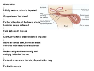 Obstruction
↓
Initially venous return is impaired
↓
Congestion of the bowel
↓
Further dilatation of the bowel which
becomes purple coloured
↓
Fluid collects in the sac
↓
Eventually arterial blood supply is impaired
↓
Bowel becomes dark, brownish black
coloured with flabby and friable wall
↓
Bacteria migrate transerosally and
multiply in fluid of the sac
↓
Perforation occurs at the site of constriction ring
↓
Peritonitis occurs.
 