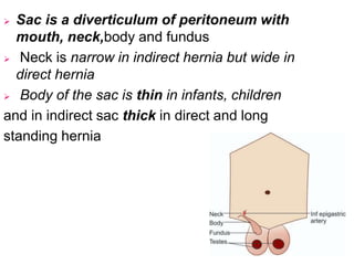  Sac is a diverticulum of peritoneum with
mouth, neck,body and fundus
 Neck is narrow in indirect hernia but wide in
direct hernia
 Body of the sac is thin in infants, children
and in indirect sac thick in direct and long
standing hernia
 