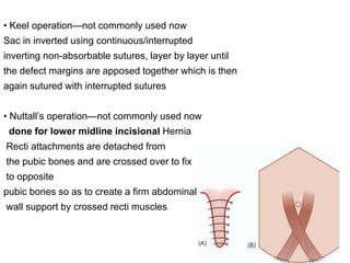 • Keel operation—not commonly used now
Sac in inverted using continuous/interrupted
inverting non-absorbable sutures, layer by layer until
the defect margins are apposed together which is then
again sutured with interrupted sutures
• Nuttall’s operation—not commonly used now
done for lower midline incisional Hernia
Recti attachments are detached from
the pubic bones and are crossed over to fix
to opposite
pubic bones so as to create a firm abdominal
wall support by crossed recti muscles
 