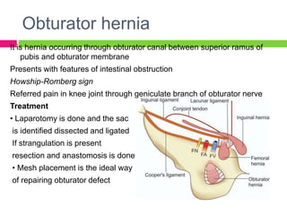 Obturator hernia
It is hernia occurring through obturator canal between superior ramus of
pubis and obturator membrane
Presents with features of intestinal obstruction
Howship-Romberg sign
Referred pain in knee joint through geniculate branch of obturator nerve
Treatment
• Laparotomy is done and the sac
is identified dissected and ligated
If strangulation is present
resection and anastomosis is done
• Mesh placement is the ideal way
of repairing obturator defect
 