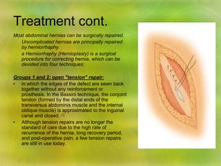 Treatment cont.
Most abdominal hernias can be surgically repaired.
Uncomplicated hernias are principally repaired
by herniorrhaphy.
a Herniorrhaphy (Hernioplasty) is a surgical
procedure for correcting hernia, which can be
devided into four techniques:
Groups 1 and 2: open "tension" repair:
• in which the edges of the defect are sewn back
together without any reinforcement or
prosthesis. In the Bassini technique, the conjoint
tendon (formed by the distal ends of the
transversus abdominis muscle and the internal
oblique muscle) is approximated to the inguinal
canal and closed. [4]
• Although tension repairs are no longer the
standard of care due to the high rate of
recurrence of the hernia, long recovery period,
and post-operative pain, a few tension repairs
are still in use today.
 