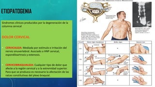 ETIOPATOGENIA 
Síndromes clínicos producidos por la degeneración de la columna cervical 
DOLOR CERVICAL 
•CERVICALGIA: Mediada por estímulo e irritación del nervio sinuvertebral. Asociado a HNP cervical, espondiloartrosis y estenosis. 
•CERVICOBRAQUIALGIA: Cualquier tipo de dolor que afecte a la región cervical y a la extremidad superior. Para que se produzca es necesario la afectación de las raíces constitutivas del plexo braquial.  