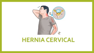 HERNIA CERVICAL
 