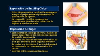 Reparación del haz iliopúbico.
• El haz iliopúbico tiene una función análoga en
el espacio preperitoneal al proporcionar un
punto fuerte de fijación.
• La reparación combina la reparación
preperitoneal basada en los tejidos con la
implantación de una malla.
Reparación de Kugel
• Esta reparación se dirige a llevar al máximo el
acceso preperitoneal con incisiones pequeñas
de la piel y aponeurosis.
• Se realiza una incisión cutánea oblicua casi 2 a
3 cm por arriba del anillo inguinal profundo
• Se realiza una incisión de 3 a 4 cm de longitud
en la unión del tercio externo con los dos
tercios
• internos entre estas dos estructuras
 