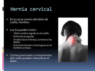 Hernia cervical<br />Es la causa común del dolor de cuello, hombro. <br />Los Sx pueden incluir<br /> Dolor sordo o agudo ...