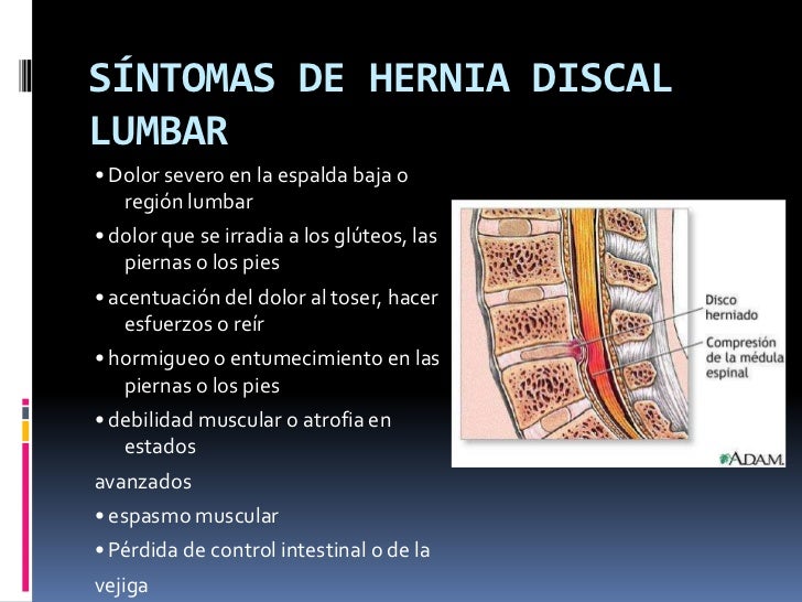 Duele el músculo de la espalda a la izquierda la espátula