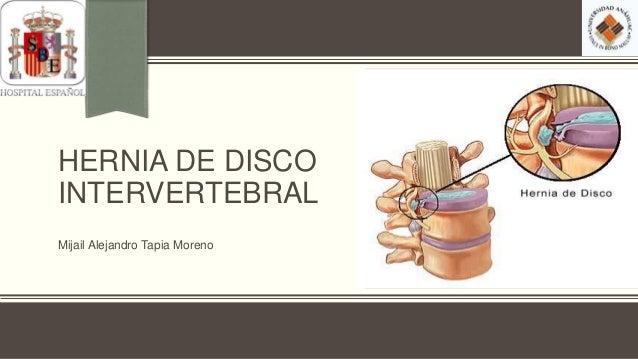 Como librarse del ruido en la oreja a sheynom la osteocondrosis