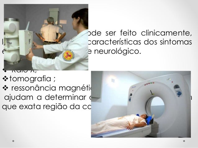 Exame hernia de disco