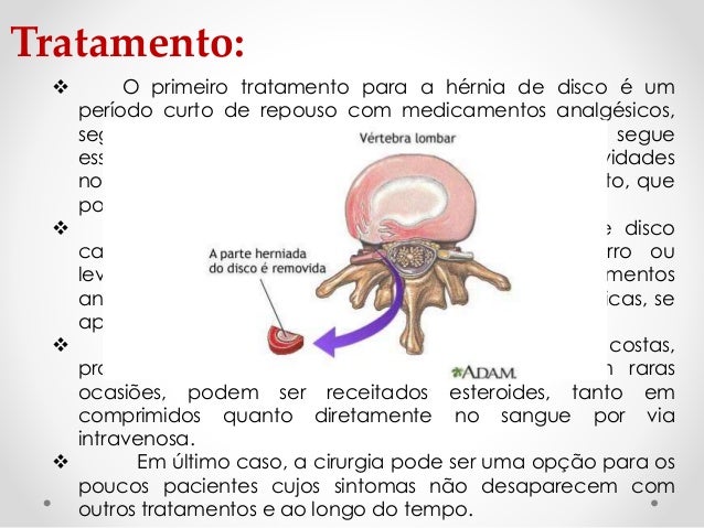 Exame hernia de disco