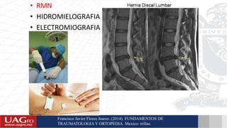 • RMN
• HIDROMIELOGRAFIA
• ELECTROMIOGRAFIA
Francisco Javier Flores Juarez. (2014). FUNDAMENTOS DE
TRAUMATOLOGIA Y ORTOPEDIA. Mexico: trillas.
 