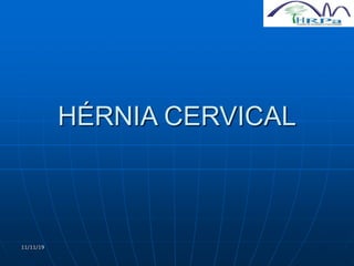 11/11/19
HÉRNIA CERVICAL
 