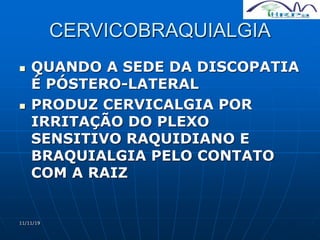 11/11/19
CERVICOBRAQUIALGIA
 QUANDO A SEDE DA DISCOPATIA
É PÓSTERO-LATERAL
 PRODUZ CERVICALGIA POR
IRRITAÇÃO DO PLEXO
SENSITIVO RAQUIDIANO E
BRAQUIALGIA PELO CONTATO
COM A RAIZ
 