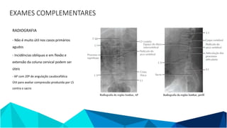 EXAMES COMPLEMENTARES
RADIOGRAFIA
- Não é muito útil nos casos primários
agudos
- Incidências oblíquas e em flexão e
extensão da coluna cervical podem ser
úteis
- AP com 20º de angulação caudocefálica
Útil para avaliar compressão produzida por L5
contra o sacro
 