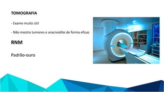 TOMOGRAFIA
- Exame muito útil
- Não mostra tumores e aracnoidite de forma eficaz
RNM
Padrão-ouro
 