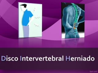 DDisco IIntervertebral HHerniado
 
