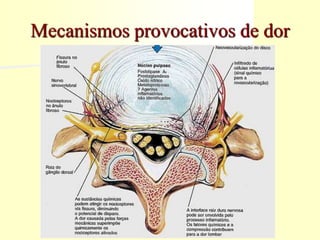 Mecanismos provocativos de dor
 
