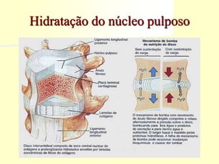Hidratação do núcleo pulposo
 