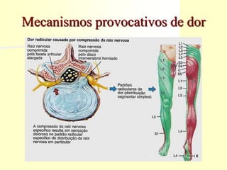 Mecanismos provocativos de dor
 