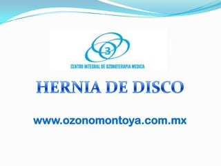 HERNIA DE DISCO www.ozonomontoya.com.mx 