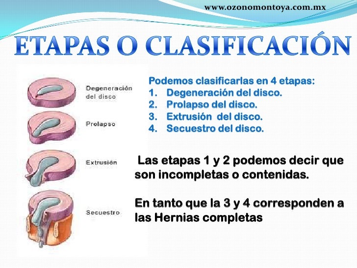 El dolor de cabeza a la osteocondrosis los indicios