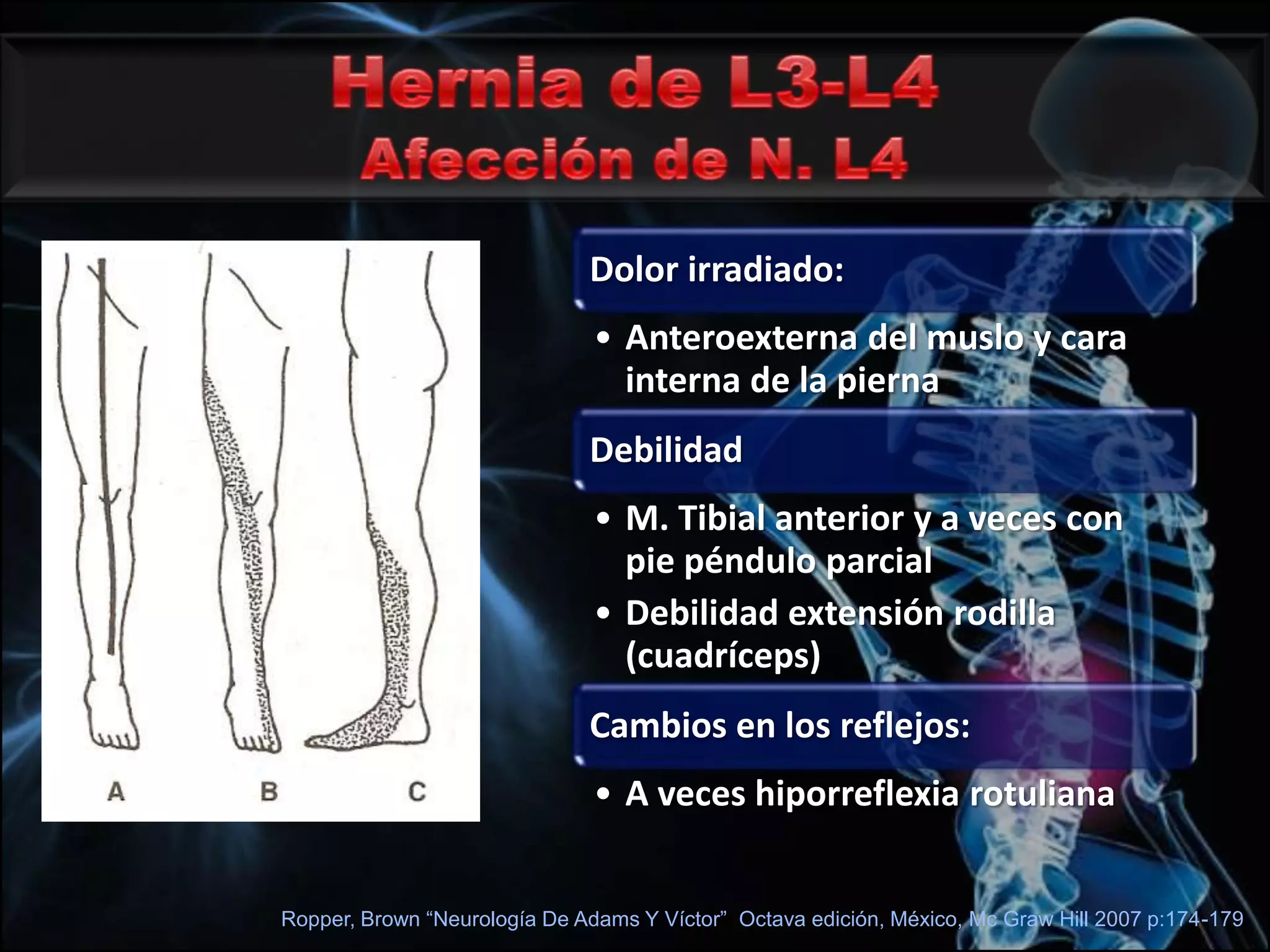 «enterrar cuchillo»