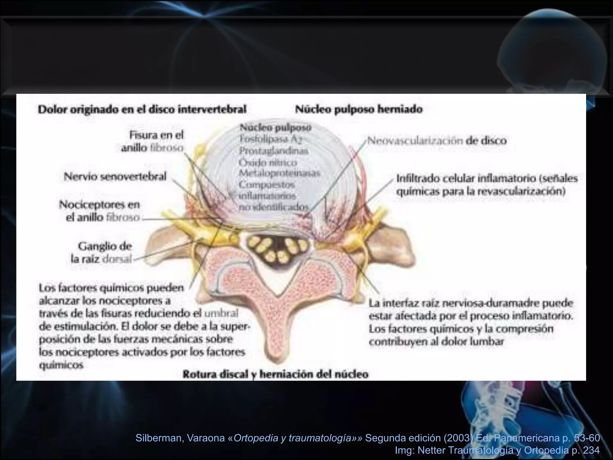 Silberman, Varaona «Ortopedia y traumatología»» Segunda edición (2003) Ed. Panamericana p. 53-60Img: Netter Traumatología y Ortopedia p. 234