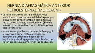 HERNIA DIAFRAGMÁTICA ANTERIOR
RETROESTERNAL (MORGAGNI)
• La hernia protruye entre el xifoides y las
inserciones costocondrales del diafragma, por
lo que se las conoce también como hernias
retro costo xifoideas, y predominan (80% de
los casos) del lado derecho, existiendo pocos
casos bilaterales.
• Hay autores que llaman hernias de Morgagni
si protruyen por el hiato esternocostal
derecho, de Larrey si lo hacen por el
izquierdo, y de Morgagni-Larrey si la abertura
es tan grande que comprende los dos hiatos.
 