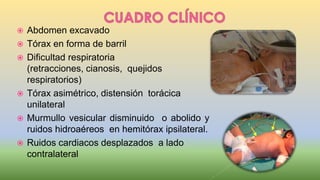  Abdomen excavado
 Tórax en forma de barril
 Dificultad respiratoria
(retracciones, cianosis, quejidos
respiratorios)
 Tórax asimétrico, distensión torácica
unilateral
 Murmullo vesicular disminuido o abolido y
ruidos hidroaéreos en hemitórax ipsilateral.
 Ruidos cardiacos desplazados a lado
contralateral
 
