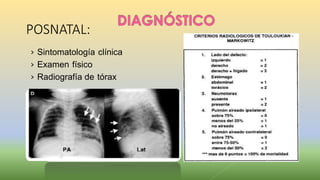 POSNATAL:
› Sintomatología clínica
› Examen físico
› Radiografía de tórax
 