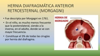 HERNIA DIAFRAGMÁTICA ANTERIOR
RETROESTERNAL (MORGAGNI)
• Fue descripta por Morgagni en 1761.
• En el niño, es mucho menos frecuente
que la posterolateral, siendo a la
inversa, en el adulto, donde se ve con
mayor frecuencia.
• Constituye el 3% de todas las cirugías
por hernia del diafragma.
 