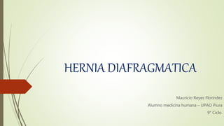 HERNIA DIAFRAGMATICA
Mauricio Reyes Floríndez
Alumno medicina humana – UPAO Piura
9° Ciclo.
 